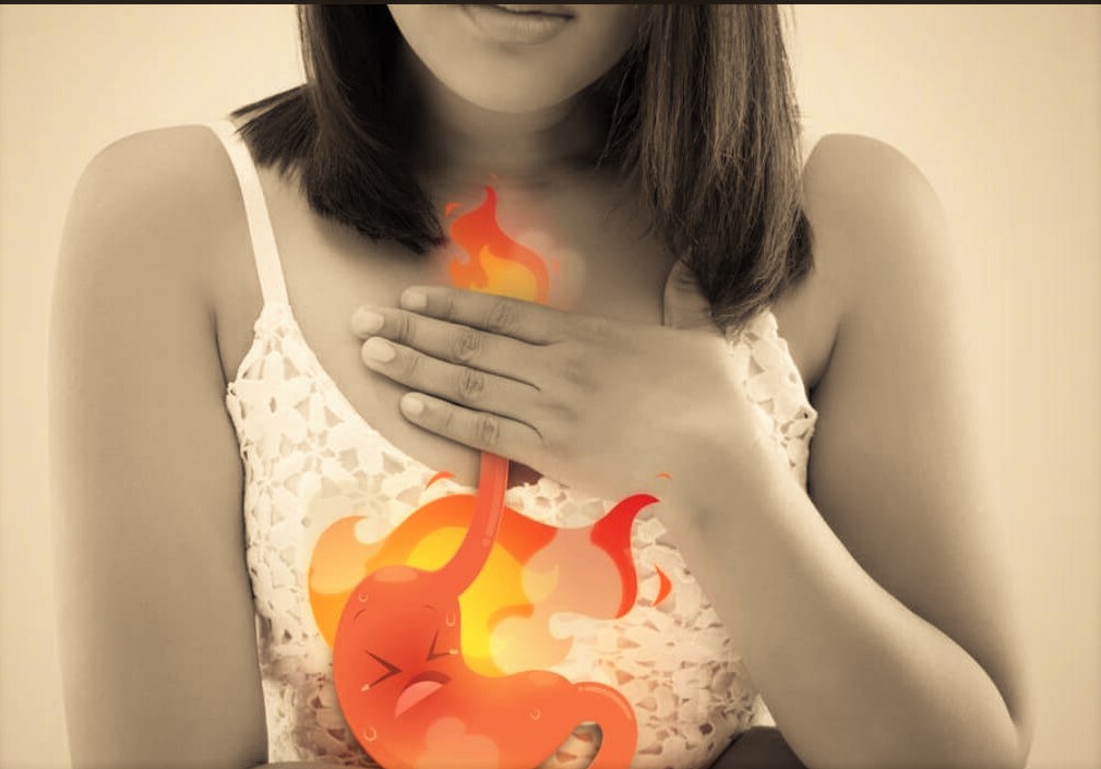 The best 27 foods help heartburn