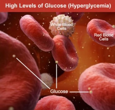 What are symptoms for high blood sugar